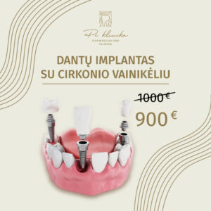 Piklinika 1080x1080_dantu implantas-1