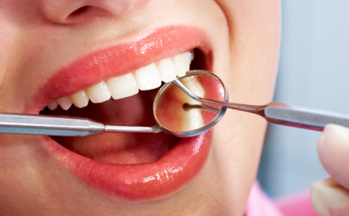 Kaip atliekama burnos higiena?